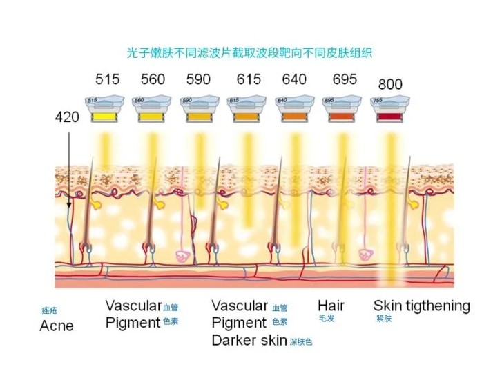 五大光子嫩膚技術(shù)（IPL、DPL、OPT、APT、BBL）及濾光片區(qū)別